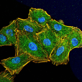 VIM Antibody