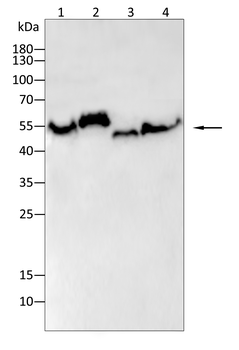 VIM Antibody