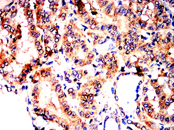 FAP Antibody