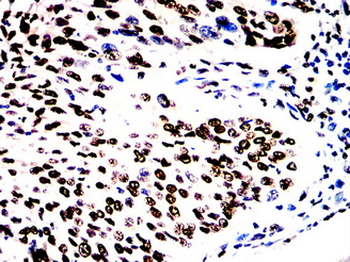 MAPK14 Antibody