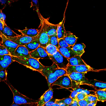 TP53 Antibody