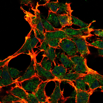 TLR2 Rabbit Polyclonal Antibody