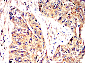 TLR2 Rabbit Polyclonal Antibody