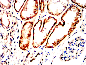 TLR2 Rabbit Polyclonal Antibody