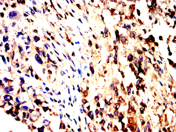 TLR2 Rabbit Polyclonal Antibody