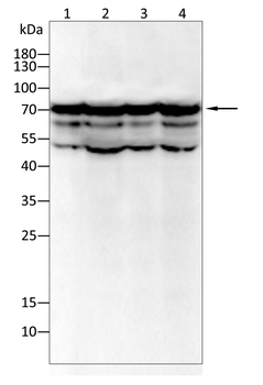 TLR2 Rabbit Polyclonal Antibody