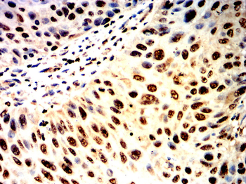 NCOR1 Antibody