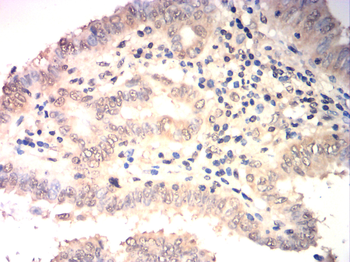 NCOR1 Antibody