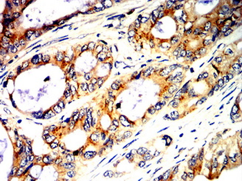 CDH2 Antibody