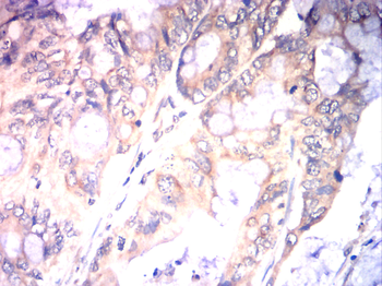 CDH2 Antibody