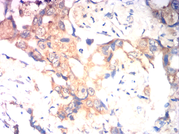 HK2 Antibody