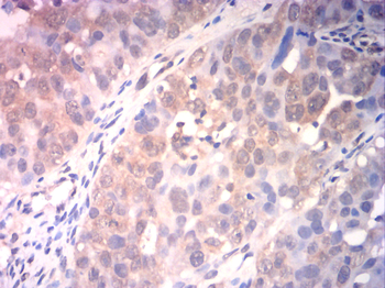 CA9 Antibody