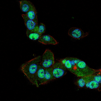 MEF2C Rabbit Polyclonal Antibody