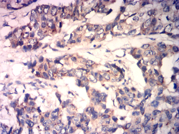 MEF2C Rabbit Polyclonal Antibody