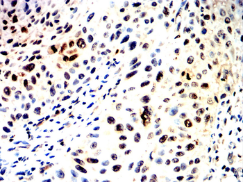 MEF2C Rabbit Polyclonal Antibody