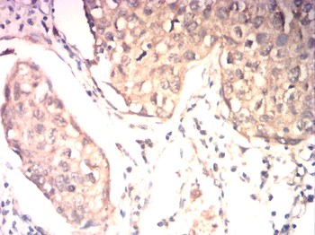 MEF2C Rabbit Polyclonal Antibody