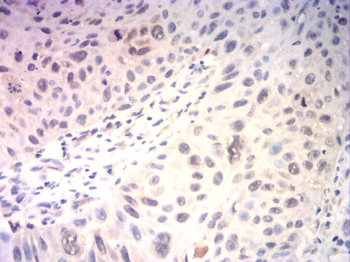 MEF2C Rabbit Polyclonal Antibody