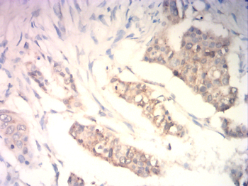 MEF2C Rabbit Polyclonal Antibody