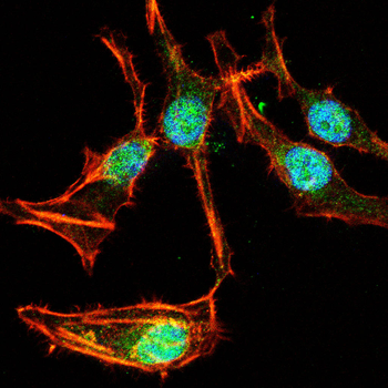 KRT5 Antibody