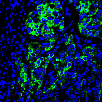 KRT5 Antibody