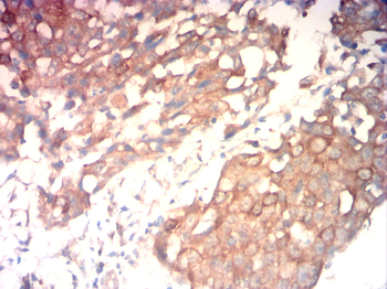 KRT5 Antibody