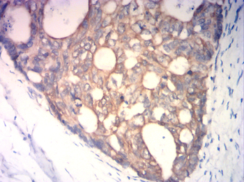 KRT5 Antibody