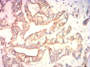 KRT5 Antibody