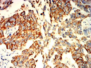 KRT5 Antibody