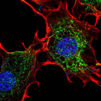 EPCAM Rabbit Polyclonal Antibody