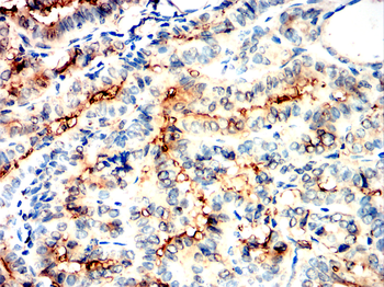 SDC1 Antibody