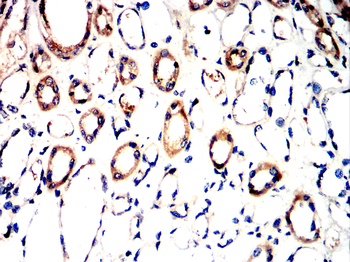 BMPR2 Antibody