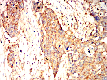 CD69 Antibody