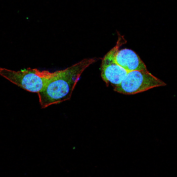 NME1 Antibody