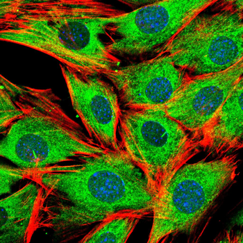 UBB Antibody
