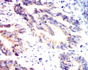 UBB Antibody