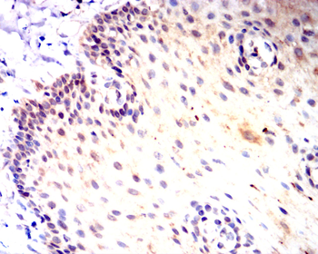 UBB Antibody