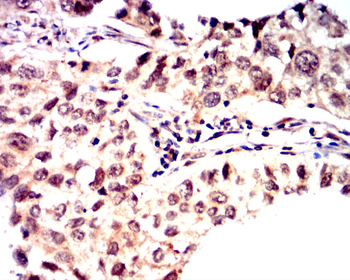 UBB Antibody