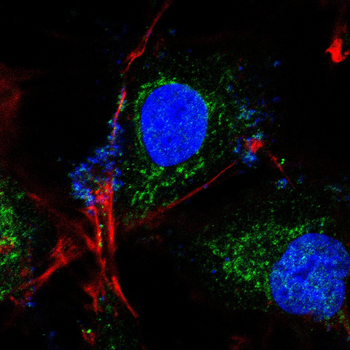 ALDH2 Antibody