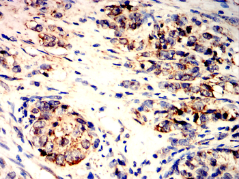 ALDH2 Antibody