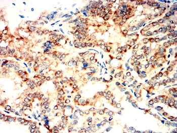 PIEZO1 Antibody