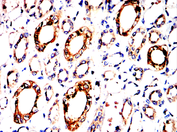 CTSD Antibody