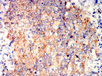 PDCD6IP Antibody
