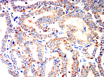 PDCD6IP Antibody