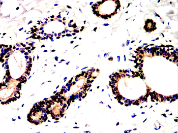 NFKB1 Antibody