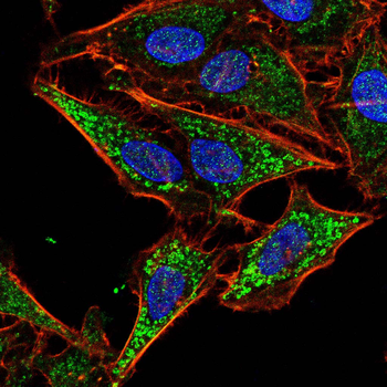 SOD2 Antibody