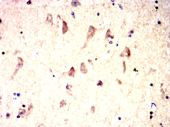 PSD95 Rabbit Polyclonal Antibody