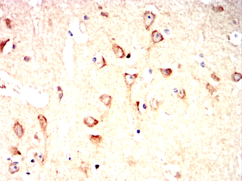 PSD95 Rabbit Polyclonal Antibody