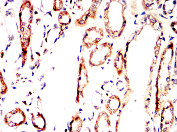 CYBB Antibody