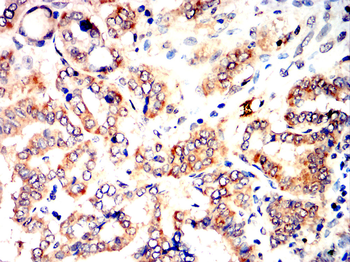 CYBB Antibody
