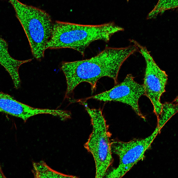 ABCG1 Rabbit Polyclonal Antibody